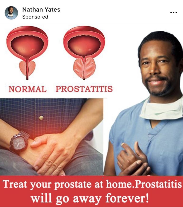 Dr. Ben Carson sposored ad. on Nathan Yates